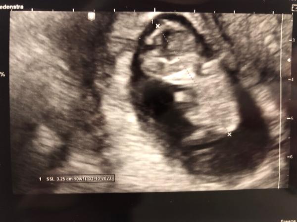 Bild zu Heute Vorsorge gehabt 🥰 - Forum für Oktober - Mamis