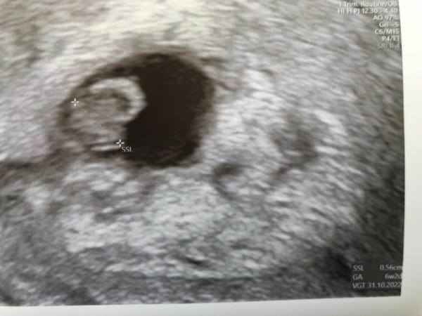 Bild zu 1. FA Termin  - Forum für Oktober - Mamis