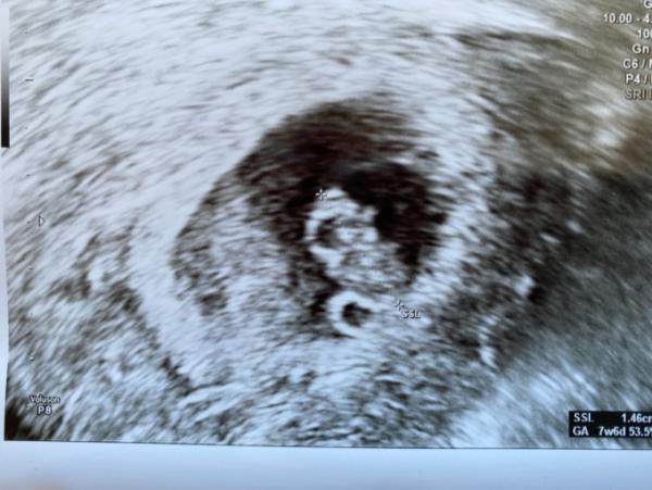 Bild zu Ein kleiner Mensch - Forum für Oktober - Mamis