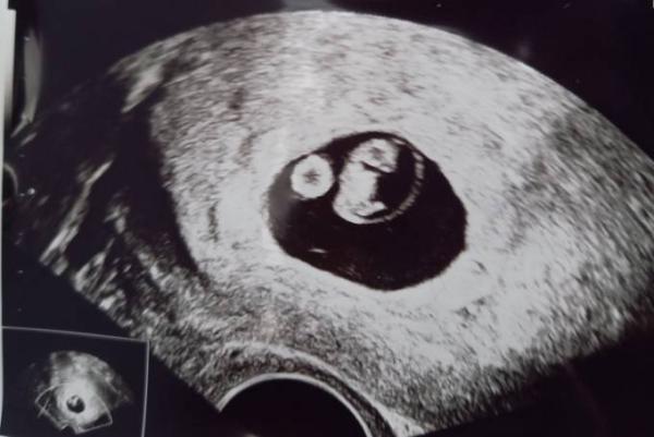 Bild zu Es hat geklappt :-) - Forum für Oktober - Mamis