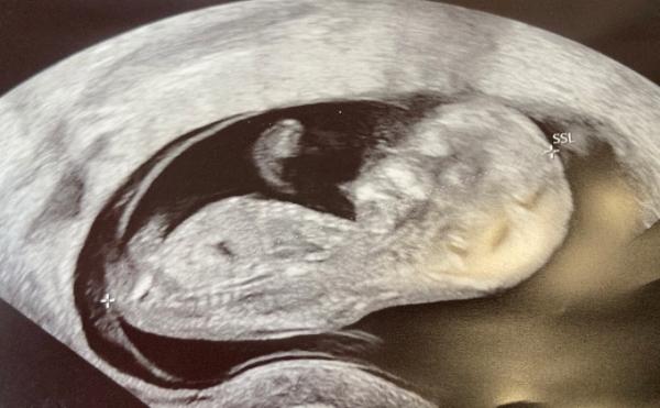 Bild zu Minimensch! - Forum für Oktober - Mamis
