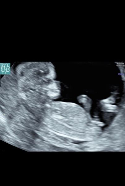 Bild zu Nub Theorie - Forum für Oktober - Mamis