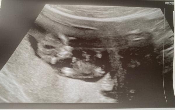 Bild zu Jetzt trau ich mich endlich auch endlich - Forum für Oktober - Mamis