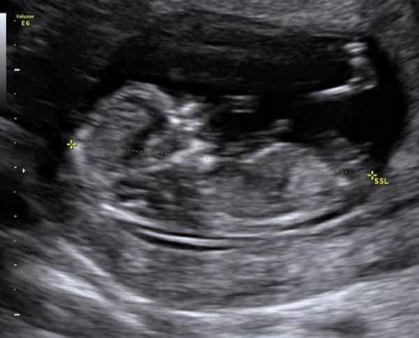 Bild zu Mädchen oder Bub - Forum für Oktober - Mamis