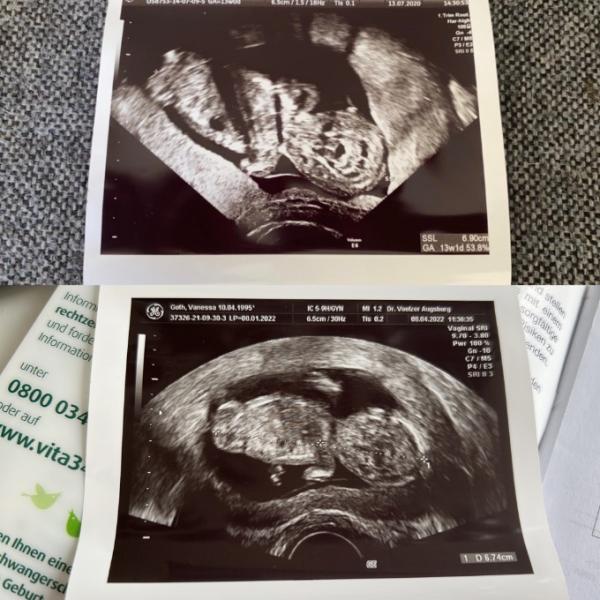 Bild zu Heute außerplanmäßig beim FA gewesen - Forum für Oktober - Mamis