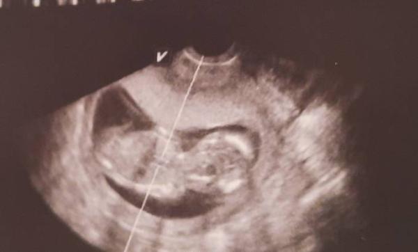 Bild zu Schon ein Outing? .. 14 ssw - Forum für Oktober - Mamis
