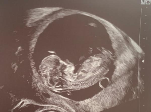 Bild zu Einfach nur happy - Forum für Oktober - Mamis