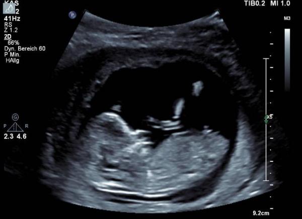 Bild zu Skull oder Nub was könnte das Geschlecht sein? - Forum für Oktober - Mamis