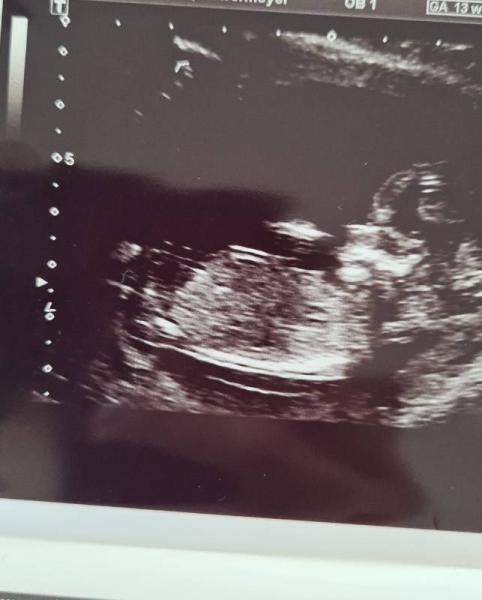 Bild zu Geschlecht ssw 14 ♥️ - Forum für Oktober - Mamis