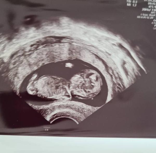 Bild zu Geschlecht Mädchen oder Bub ? - Forum für Oktober - Mamis