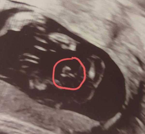 Bild zu Geschlecht 16+2 - Forum für Oktober - Mamis