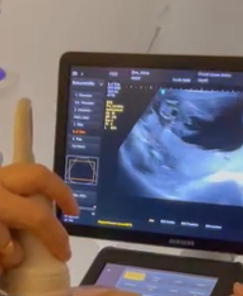 Bild zu Geschlecht 19/20 SSW - Forum für Oktober - Mamis