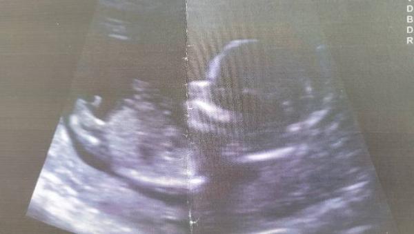 Bild zu Geschlecht Baby - NUB? - Forum für Oktober - Mamis