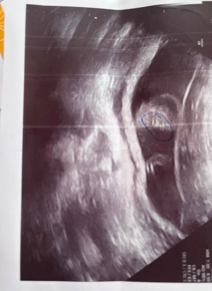 Bild zu Schwanger in der 23ssw - Forum für Oktober - Mamis