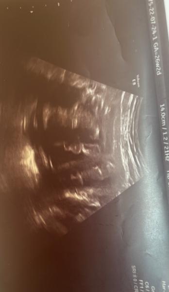 Bild zu Erst Mädchen jetzt doch junge - Forum für Oktober - Mamis