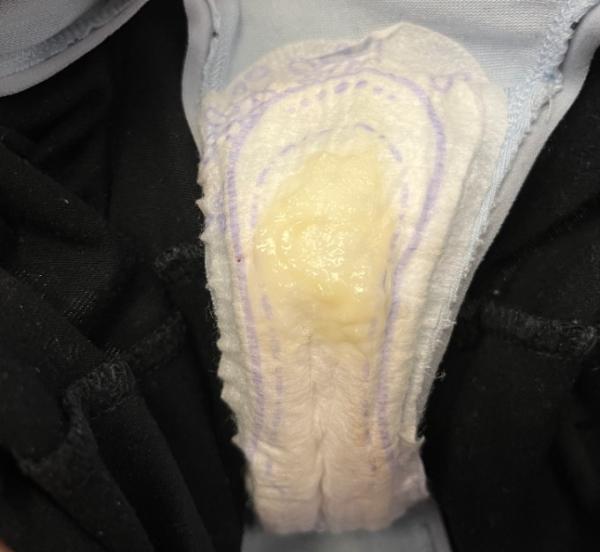 Bild zu Schleimpfropf ? Oder Ausfluss ? - Forum für Oktober - Mamis