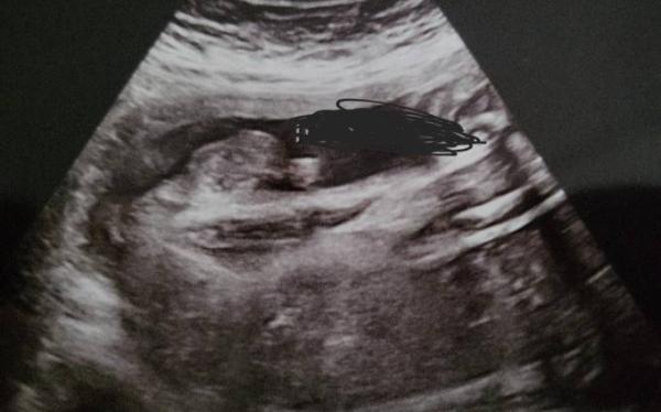 Bild zu Geschlecht???? - Forum für Oktober - Mamis