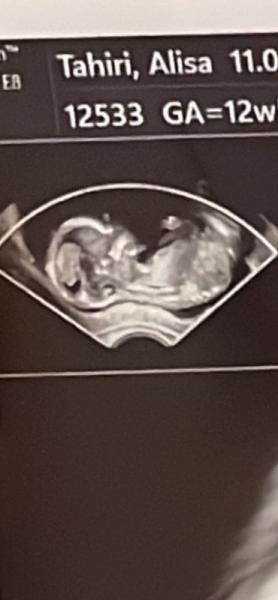 Bild zu Schwanger - Forum für Oktober - Mamis