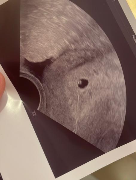 Bild zu Erleichtert 🥰🤰 - Forum für Oktober - Mamis