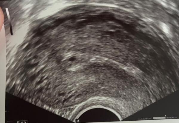 Bild zu 1 Termin bei 4+6 - Forum für Oktober - Mamis