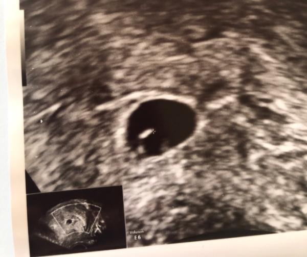 Bild zu Ultraschallbild - Forum für Oktober - Mamis