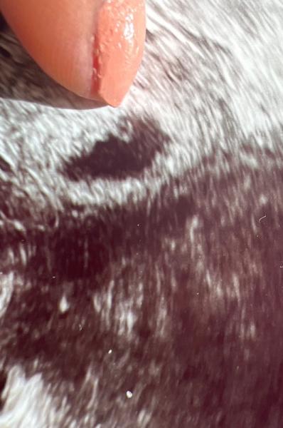Bild zu Am Ende mit den Nerven - Forum für Oktober - Mamis