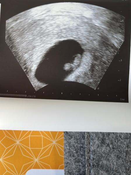 Bild zu Herzschlag ♥️ - Forum für Oktober - Mamis