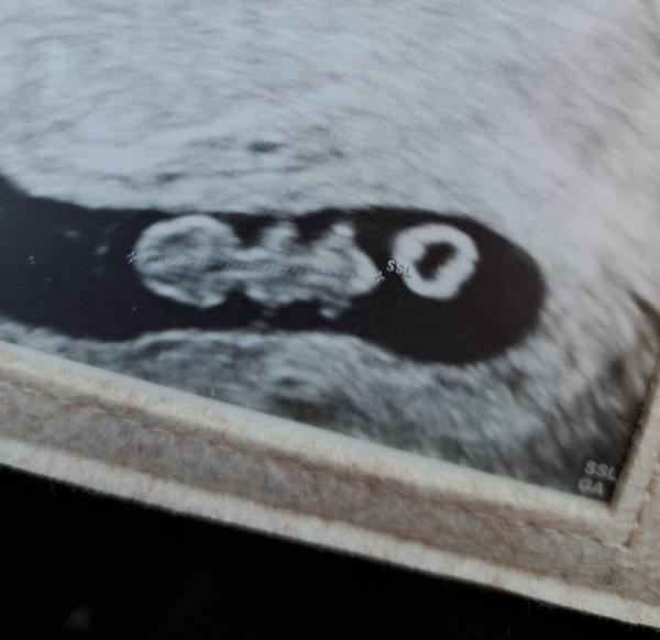Bild zu 8+0 zurück vom FA mit Bild und neuem ET - Forum für Oktober - Mamis
