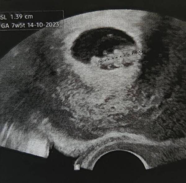 Bild zu Erster Ultraschall - Forum für Oktober - Mamis