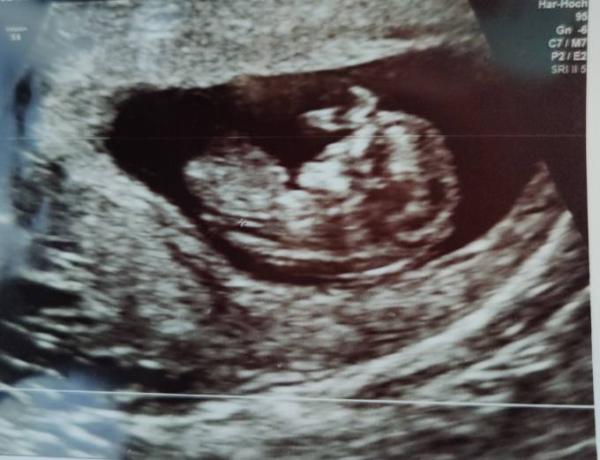 Bild zu Ich bin dann auch dabei :) - Forum für Oktober - Mamis