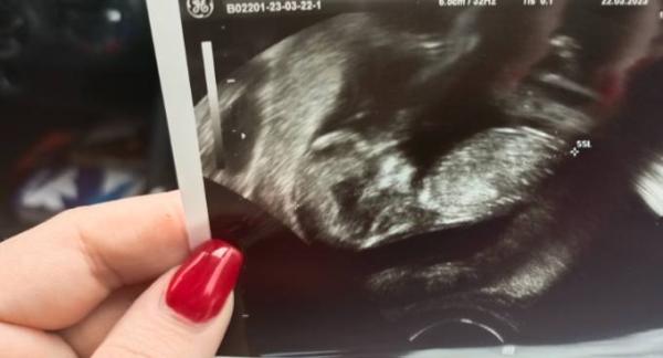 Bild zu FA Termin - Forum für Oktober - Mamis