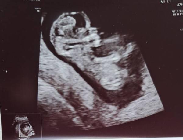 Bild zu 12+0 happy zurück vom FA mit Bild - Forum für Oktober - Mamis