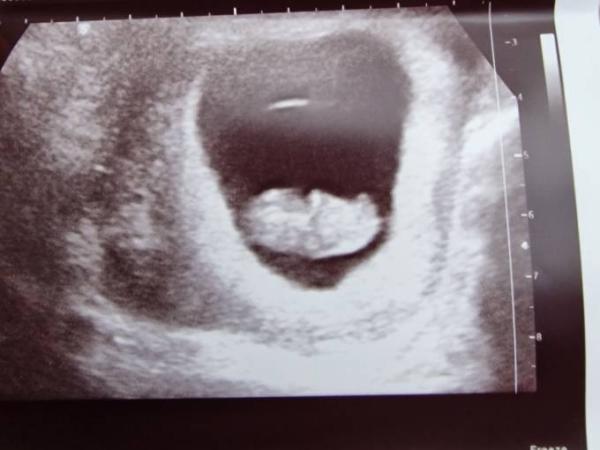 Bild zu Rutsche zurück in den Oktober - Forum für Oktober - Mamis