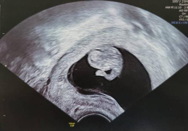 Bild zu zurück vom FA und so glücklich :) - Forum für Oktober - Mamis