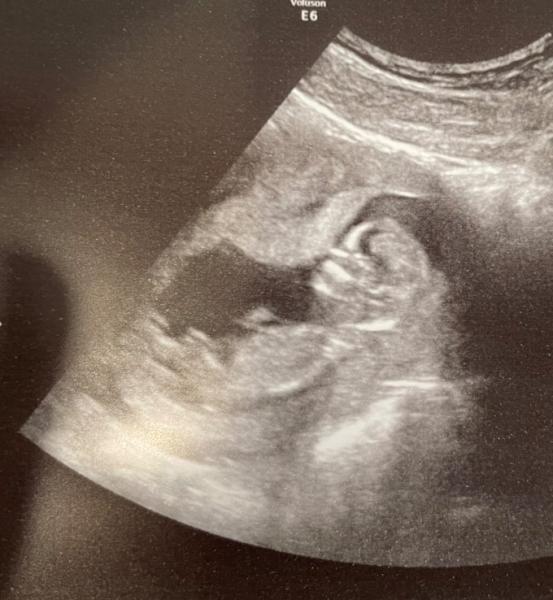 Bild zu Endlich drüber - Forum für Oktober - Mamis