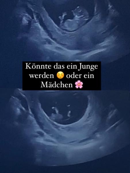 Bild zu Geschlecht : Junge oder Mädchen ? - Forum für Oktober - Mamis