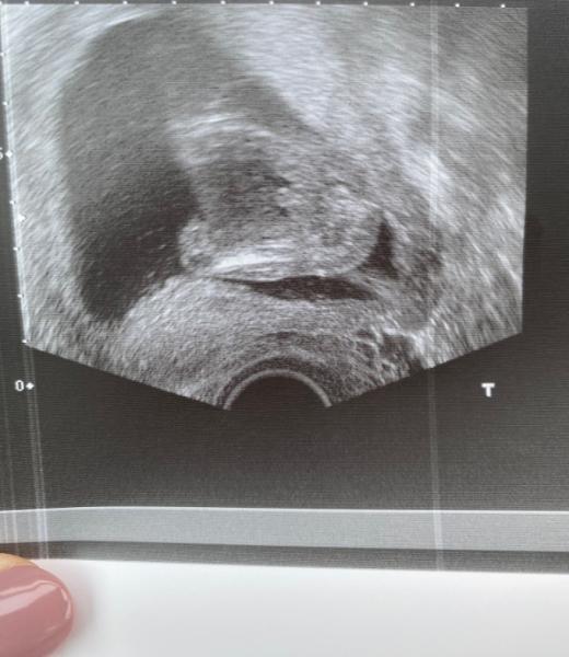 Bild zu Junge oder Mädchen? - Forum für Oktober - Mamis