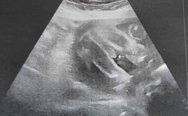 Bild zu Junge oder Mädchen - Forum für Oktober - Mamis