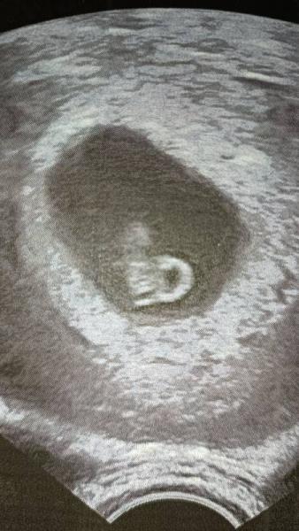 Bild zu Herzchen schlägt und Hebamme gesichert😊 - Forum für Oktober - Mamis