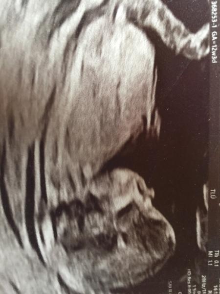 Bild zu US Bilder - Forum für Oktober - Mamis
