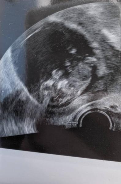 Bild zu Mini-Theorie - Forum für Oktober - Mamis