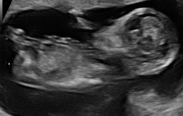 Bild zu Mädchen oder Junge? - Forum für Oktober - Mamis