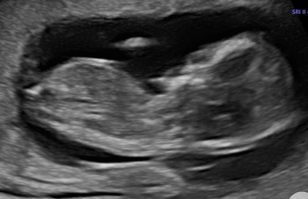 Bild zu Mädchen oder Junge? - Forum für Oktober - Mamis