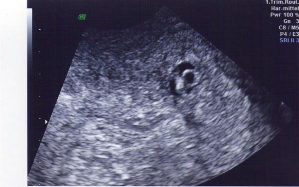Bild zu US-Bild - Forum für November - Mamis