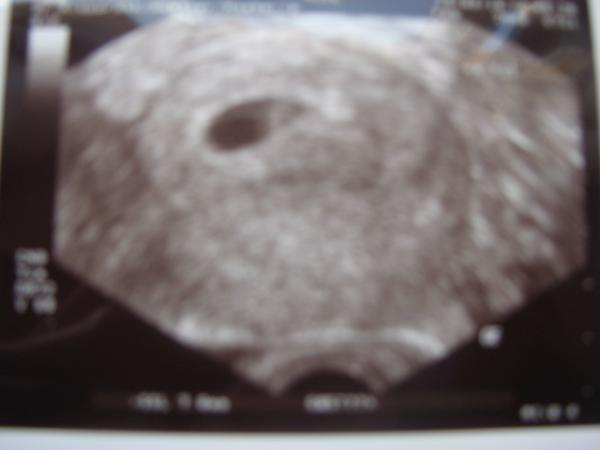 Bild zu hier will sich auch mal jemand vorstellen! :) - Forum für November - Mamis