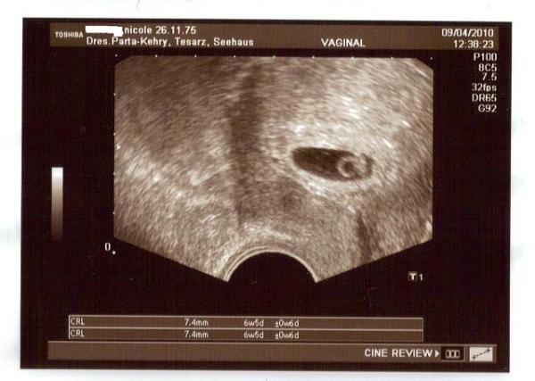 Bild zu Entlassung aus Kinderwunschklinik!! - Forum für November - Mamis