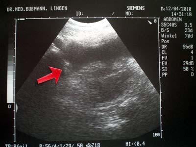 Bild zu Bewegte Bohne heute ;-) - Forum für November - Mamis