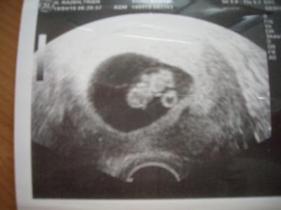 Bild zu US-Bildchen - Forum für November - Mamis