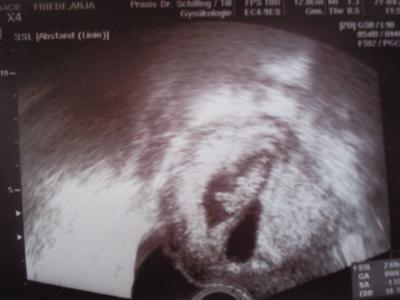 Bild zu Bericht FA- Termin - Forum für November - Mamis