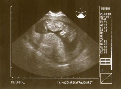 Bild zu Zurück vom FA - Forum für November - Mamis